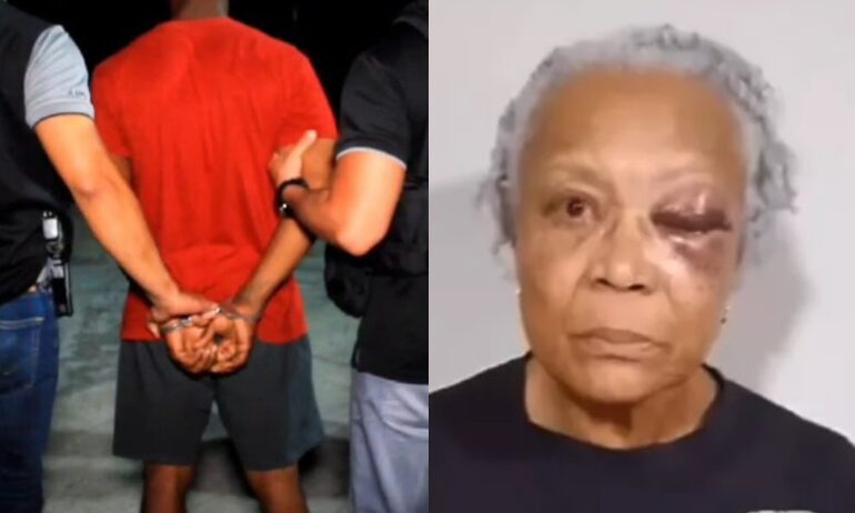 Ocho años de prisión a taxista que le robó a turistas estadounidenses 2 turista golpes 770x462 1
