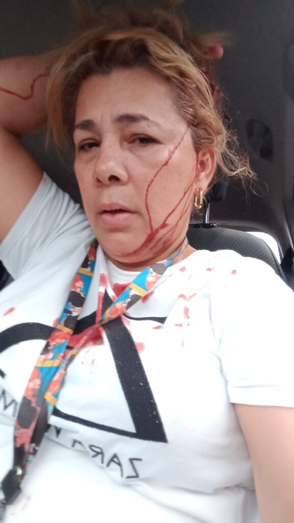 Autoridades del INADEH repudiaron actuación de facinerosos por los actos de agresión contra la directora encargada en Changuinola. 2 WhatsApp Image 2025 06 22 at 5.37.39 PM